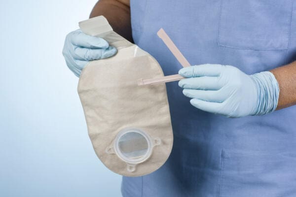  A Real Rise in the Demand for UK Manufacture of Stoma Care Products